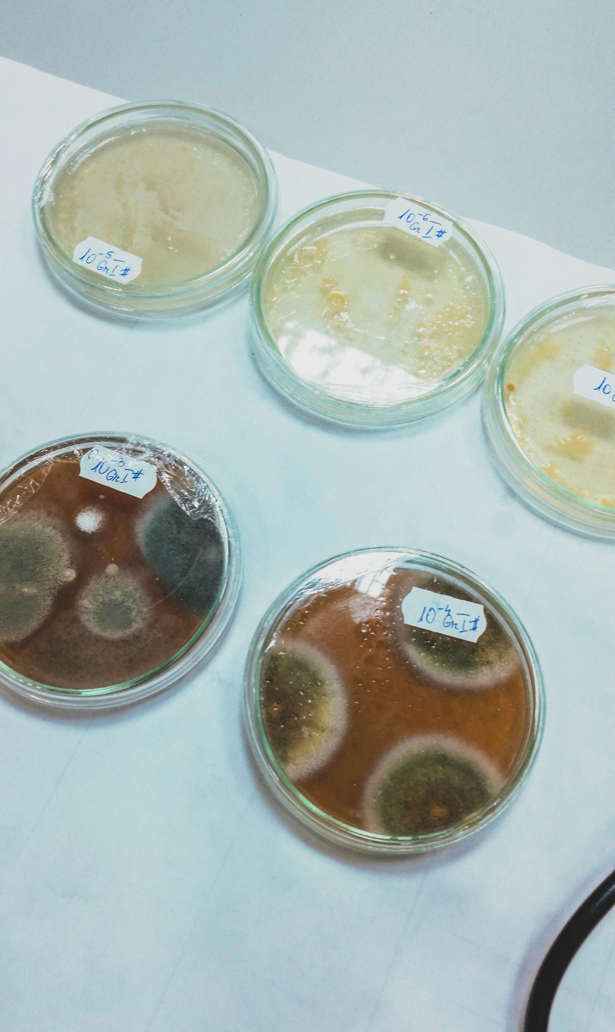 Bactériologie – Dépistage infections EUROLAB